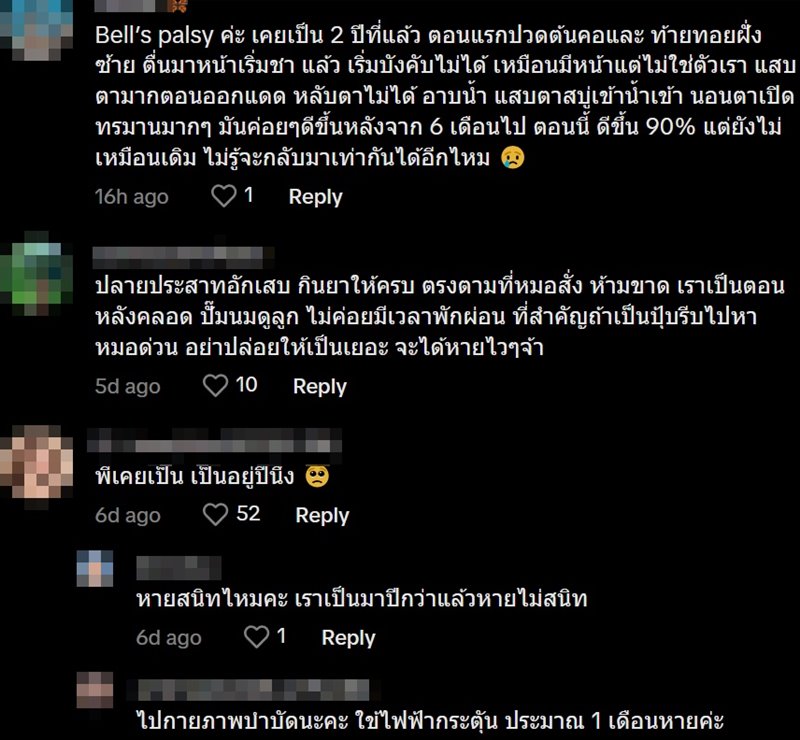 โรคหน้าเบี้ยวครึ่งซีก