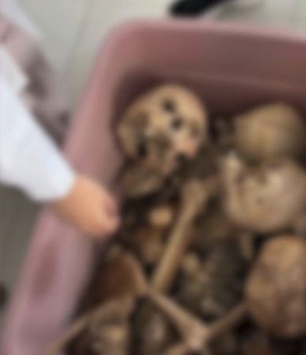 นศ.แพทย์ เซลฟี่กับกะโหลกอาจารย์ใหญ่ ผิดจรรยาบรรณหรือเปล่า