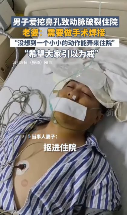 หนุ่มเลือดกำเดาไหลไม่หยุด ต้องผ่าตัดฉุกเฉิน เพราะนิสัยนี้