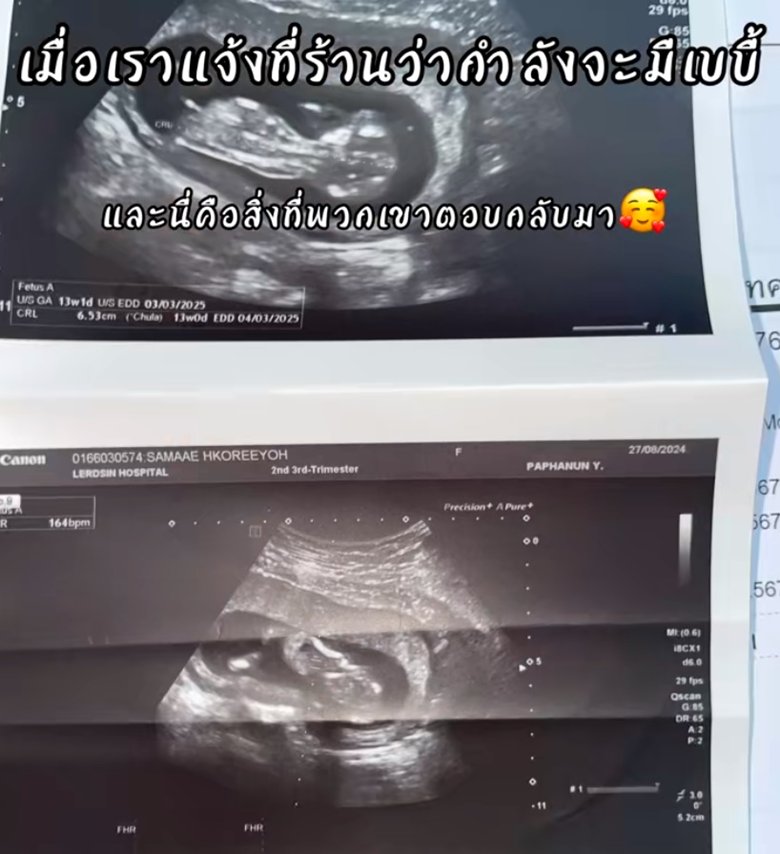 ไวรัลพนักงานเซเว่น เมื่อแจ้งทางร้านว่าตั้งครรภ์ ได้รับการตอบรับประทับใจ