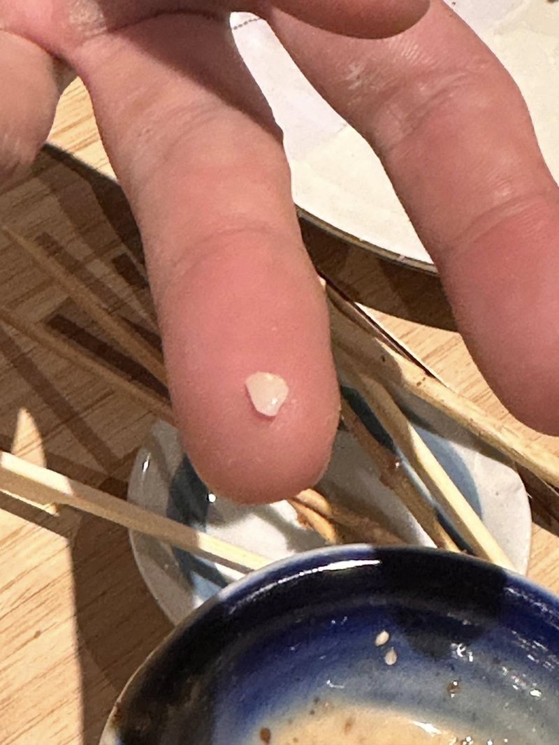 ลูกค้าโวย สั่งซาบะร้านอิซากายะดังเชียงใหม่ มีเซรามิกในเนื้อ ทำฟันแตก