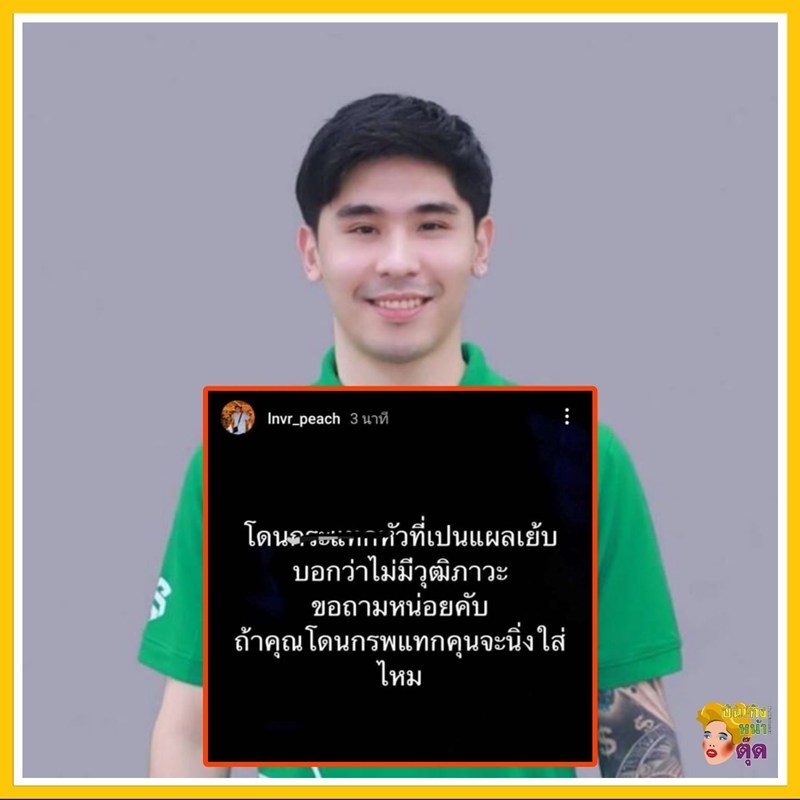 พีช สมิทธิพัฒน์ ไม่ขอทน โพสต์หลังกล้องกระแทกหัว