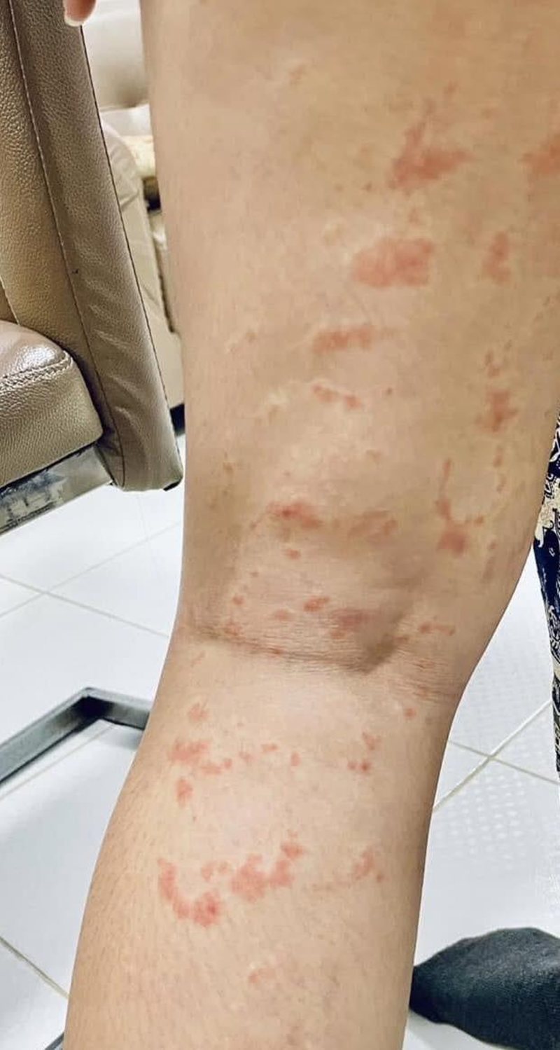 คนวิเคราะห์ ทำไม ซิฟิลิส กับ HIV ระบาดหนักมาก ที่มหาสารคาม