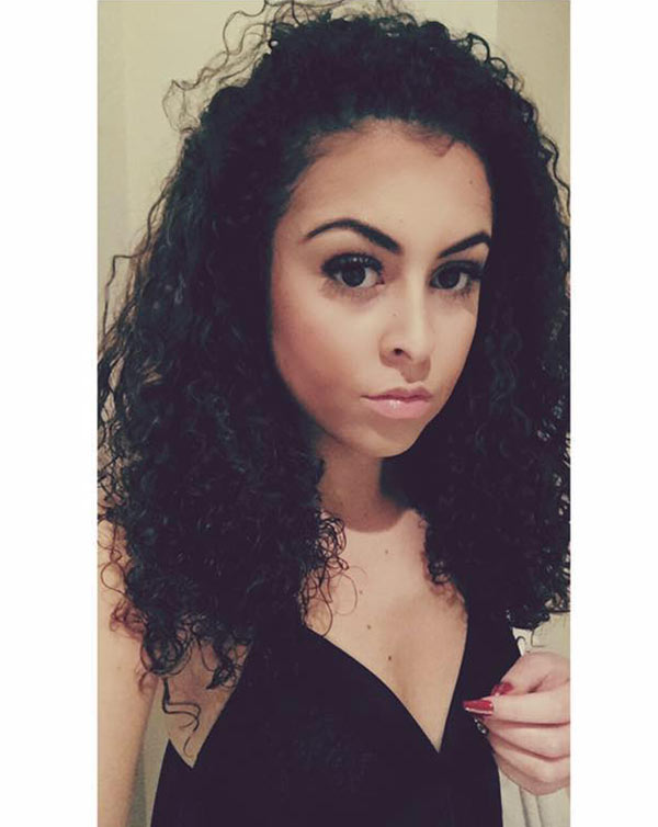 สาวเห็นผื่นขึ้นเต็มขา นึกว่าโกนขนแล้วแพ้ แต่กลับต้องช็อกเมื่อพบความจริง 