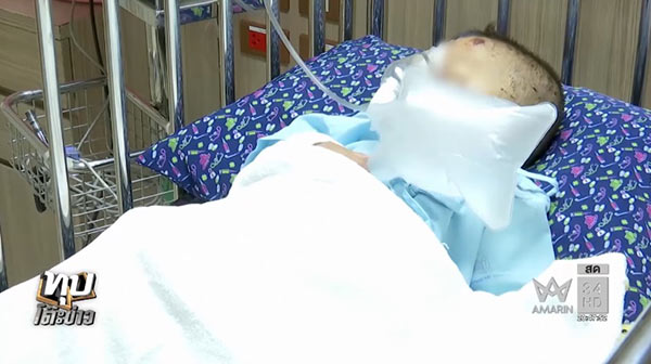 น้องน้ำ ถูกสุนัขจรจัดรุมกัด