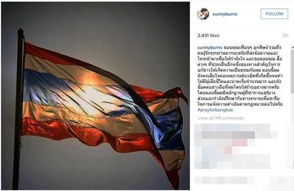 ซันนี่ เบิร์น