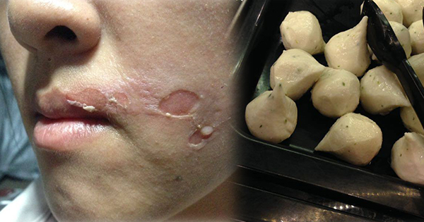 ดราม่าร้านอาหาร