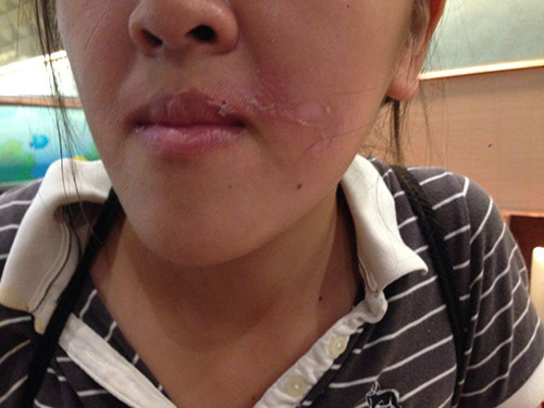 ดราม่าร้านอาหาร