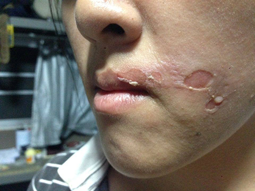 ดราม่าร้านอาหาร