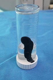 ปลิงติดหลอดลม