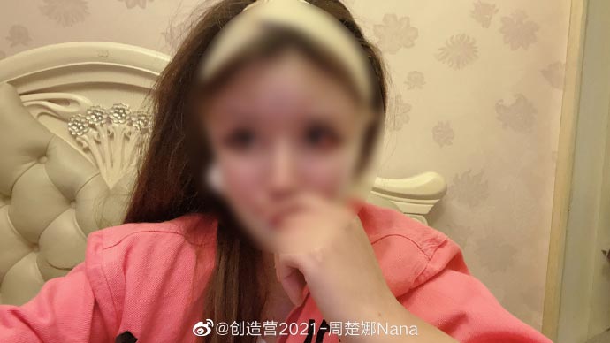 เน็ตไอดอลศัลยกรรม