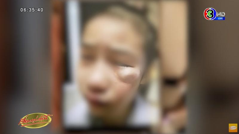 อาจารย์ ทำร้ายลูก