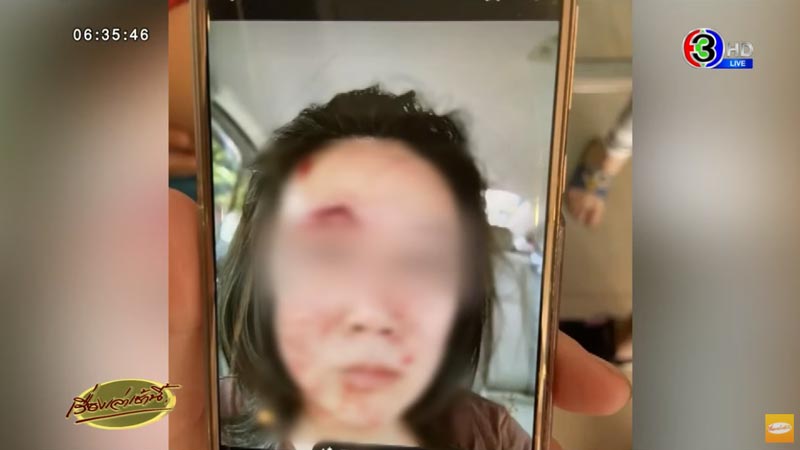 อาจารย์ ทำร้ายลูก