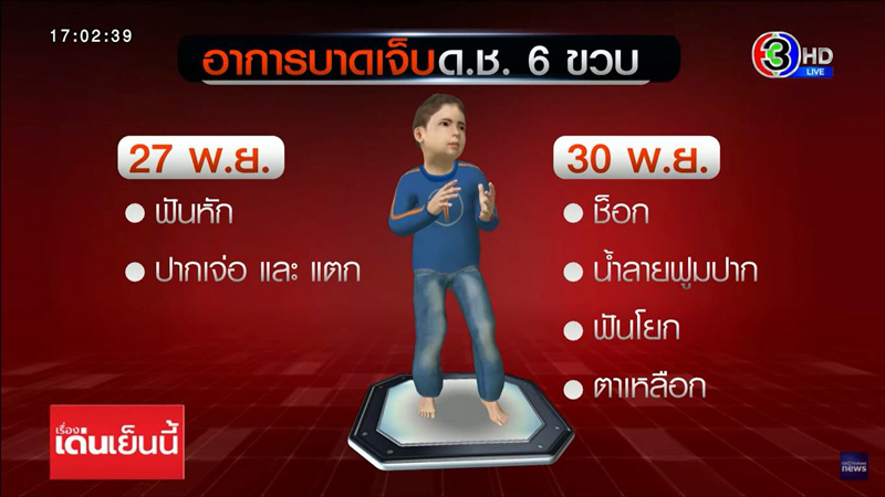 เด็กโดนเพื่อนแกล้ง