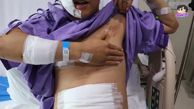 แบงค์ปิ โดนระเบิด