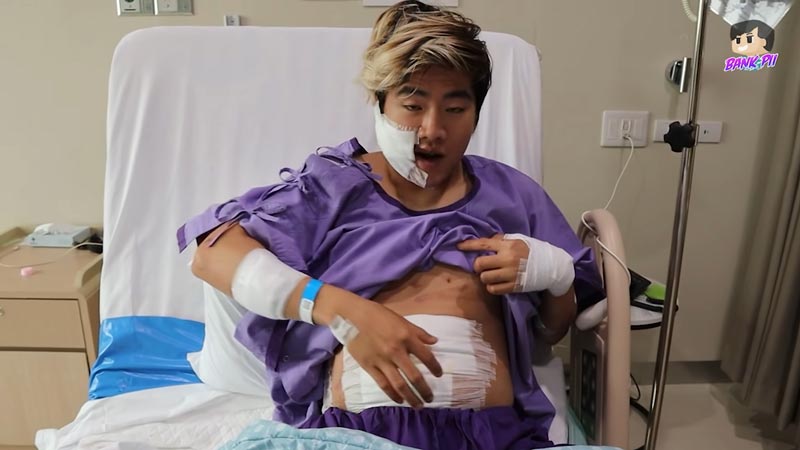 แบงค์ปิ โดนระเบิด