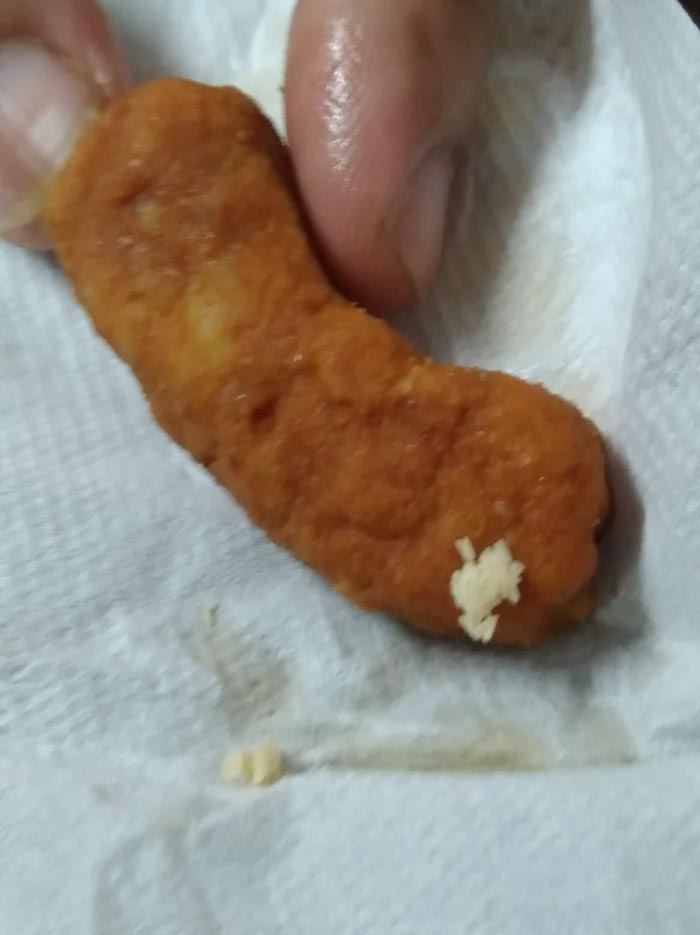 ไข่แมลงวันในอาหาร