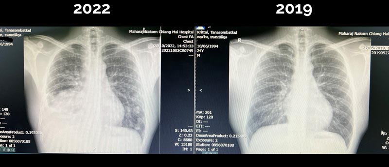 หมอกฤตไท ธนสมบัติกุล