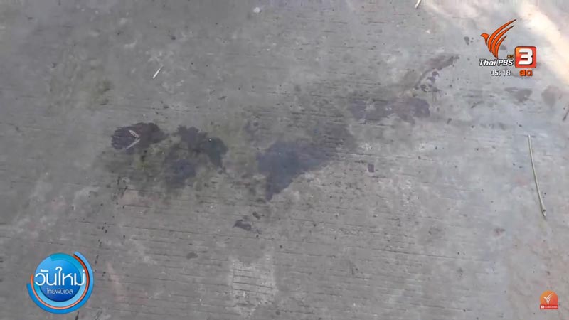 พิตบูลกัดคน