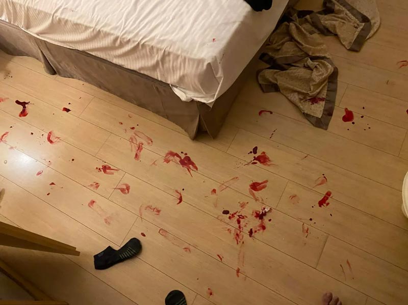 ประตูกระจกระเบิดใส่