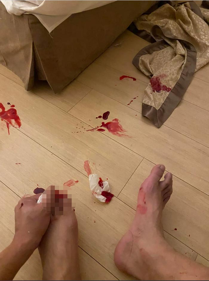 ประตูกระจกระเบิดใส่