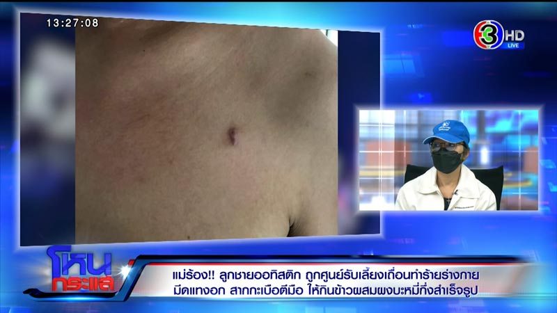 ร้องศูนย์รับเลี้ยงเด็ก ทำร้ายเด็กออทิสติก