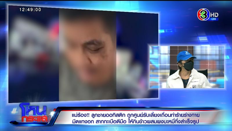 ร้องศูนย์รับเลี้ยงเด็ก ทำร้ายเด็กออทิสติก