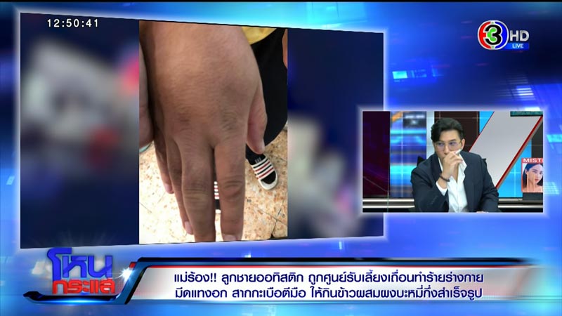 ร้องศูนย์รับเลี้ยงเด็ก ทำร้ายเด็กออทิสติก