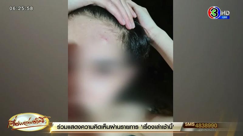 เว็บพนันอุ้มซ้อมโปรแกรมเมอร์