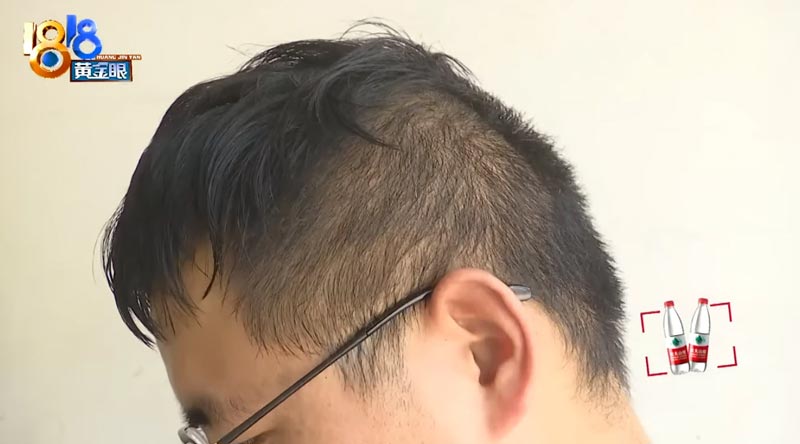 โดนหลอกตัดผมครึ่งแสน