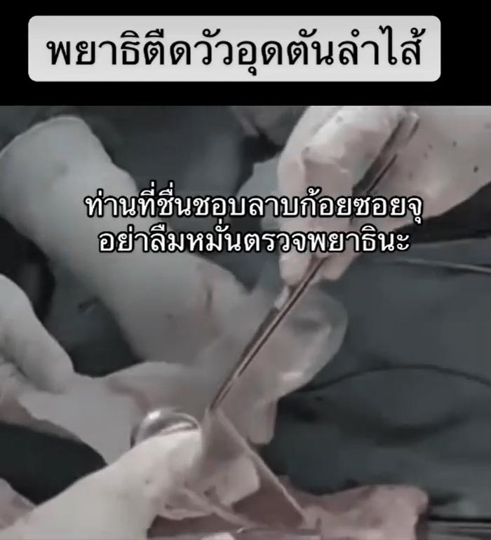 พยาธิตัวตืด