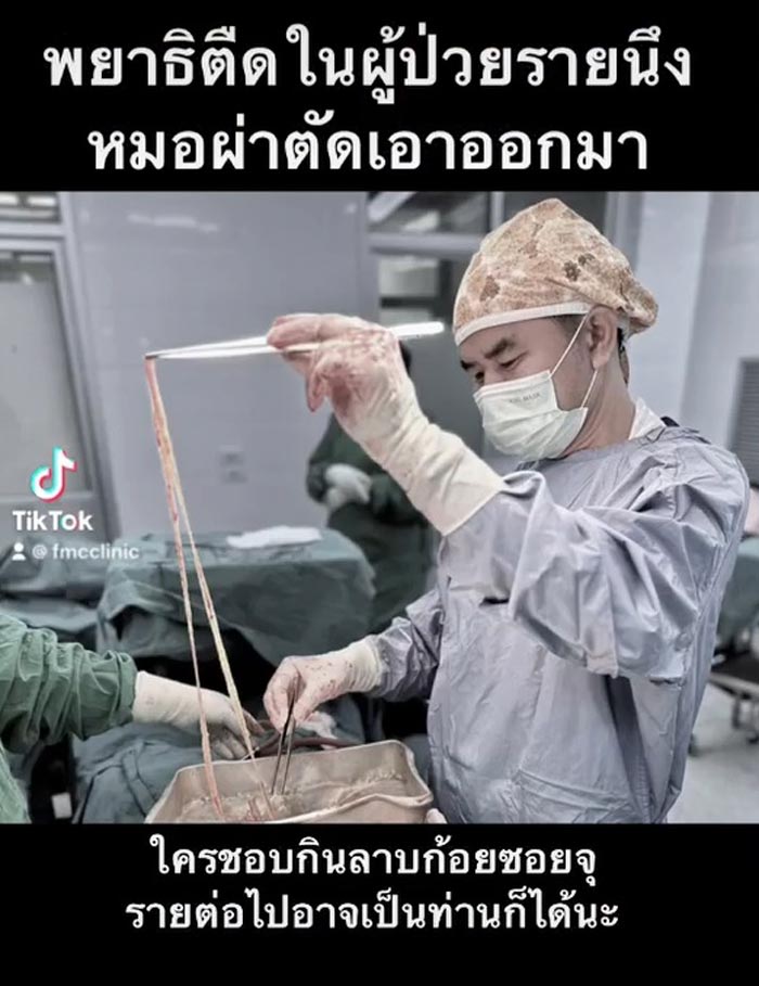 พยาธิตัวตืด