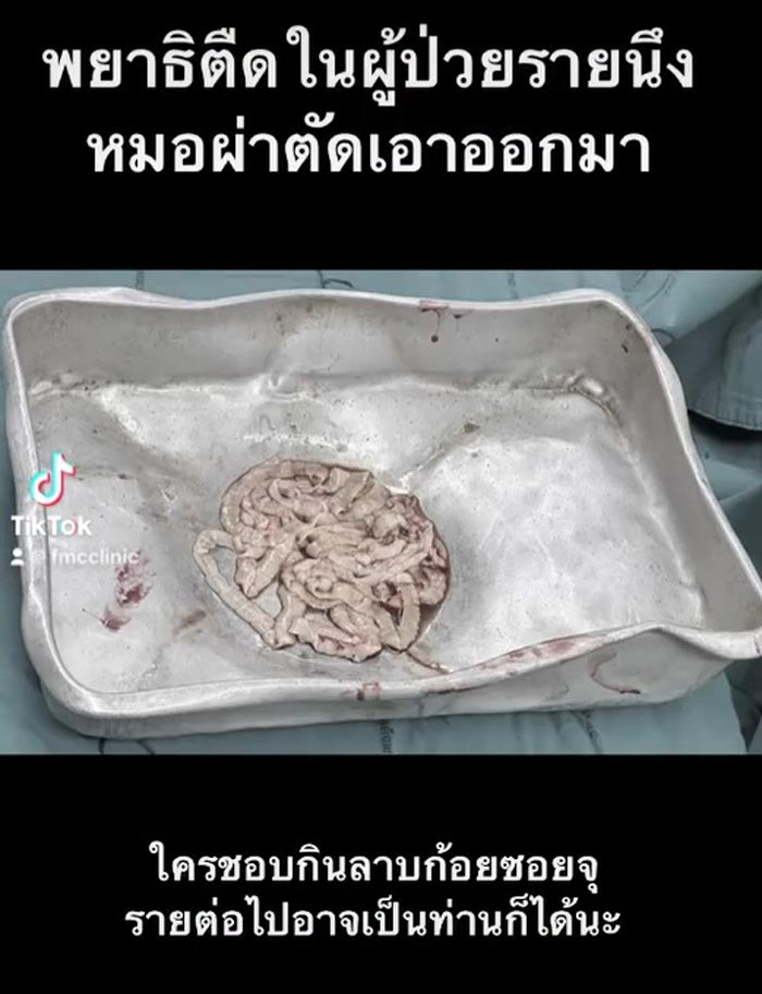 พยาธิตัวตืด