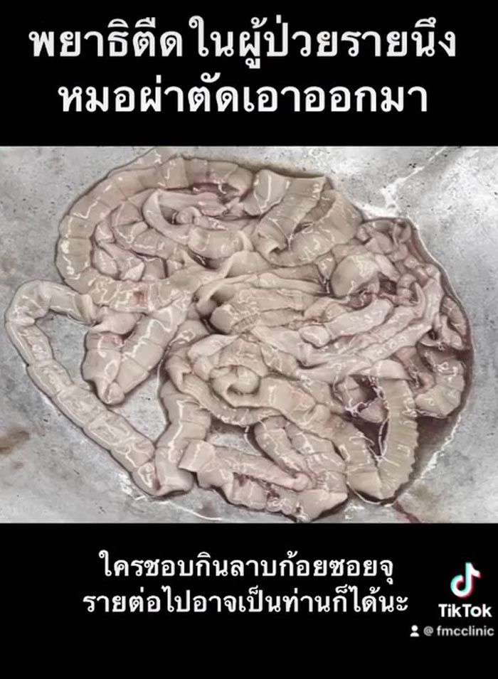 พยาธิตัวตืด