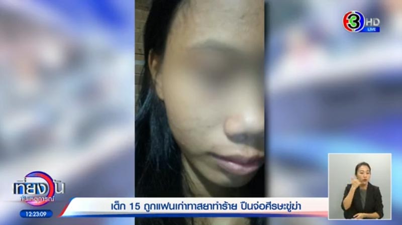 สามีทำร้ายภรรยาวัย 15