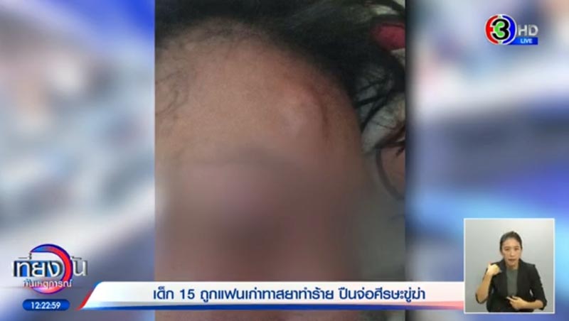 สามีทำร้ายภรรยาวัย 15