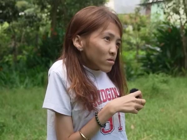 เจ้าบ่าวแต่งงานเจ้าสาวพิการ