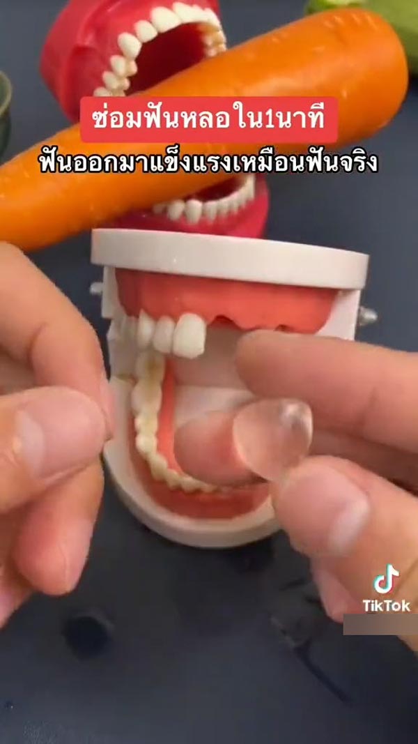 เจลฟันปลอม ซ่อมฟันเอง