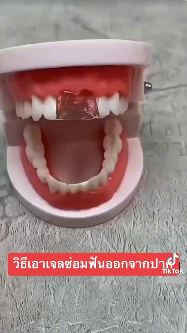 เจลฟันปลอม ซ่อมฟันเอง
