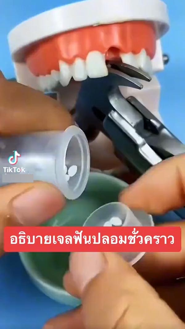 เจลฟันปลอม ซ่อมฟันเอง