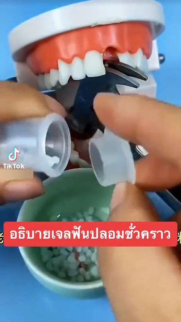 เจลฟันปลอม ซ่อมฟันเอง