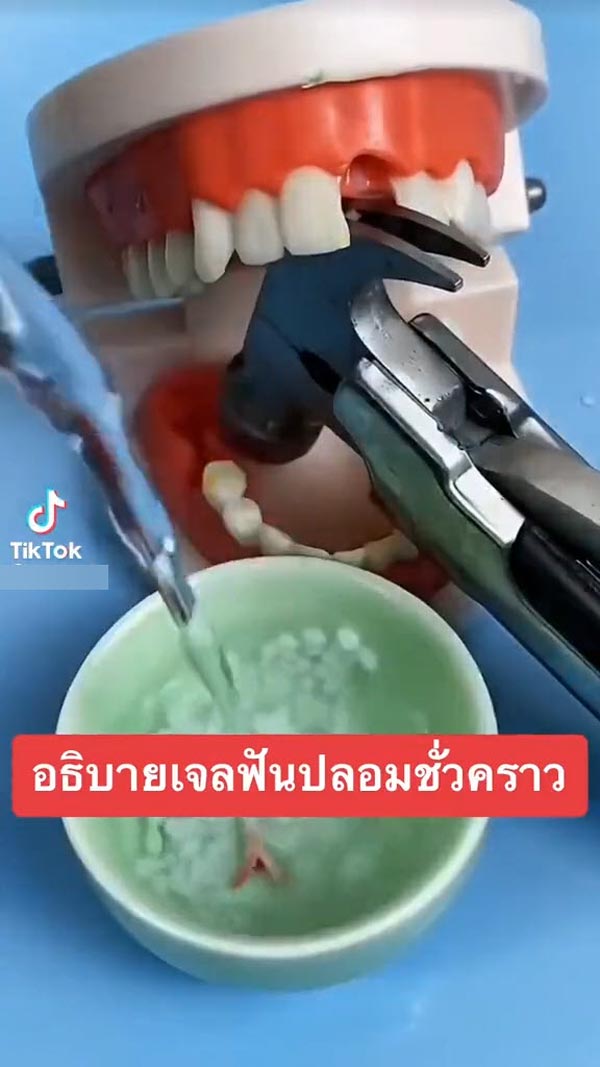 เจลฟันปลอม ซ่อมฟันเอง