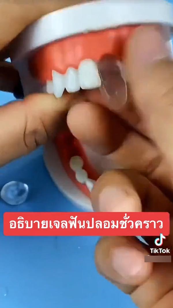 เจลฟันปลอม ซ่อมฟันเอง
