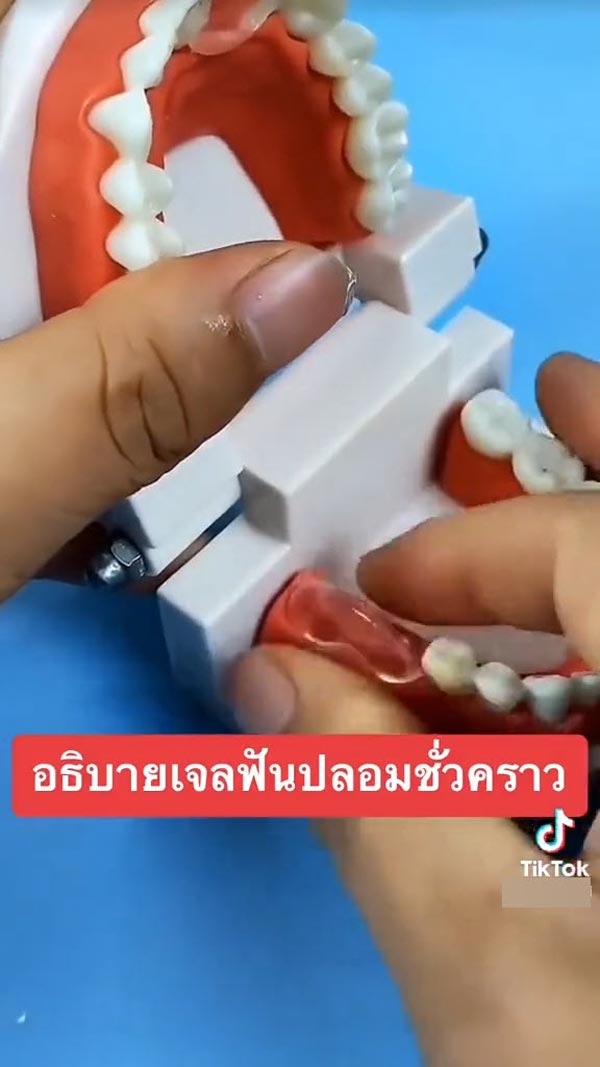 เจลฟันปลอม ซ่อมฟันเอง