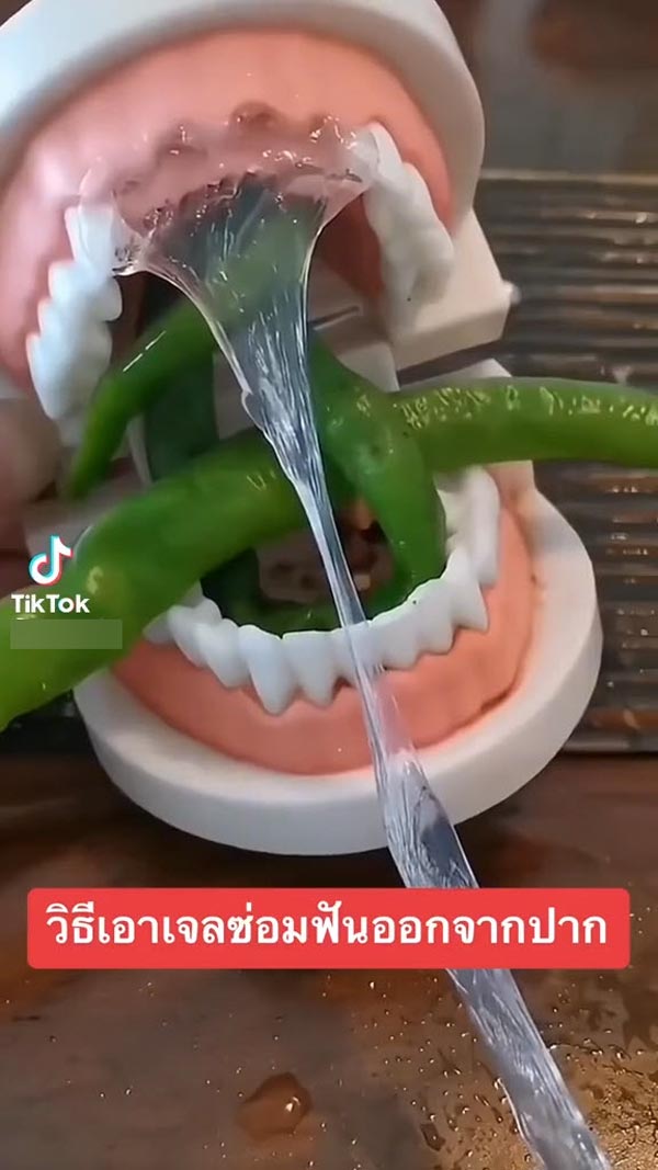 เจลฟันปลอม ซ่อมฟันเอง