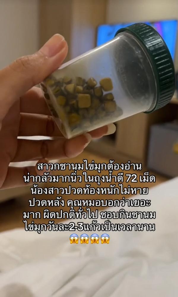 กินชานมไข่มุกเยอะจนเป็นนิ่ว