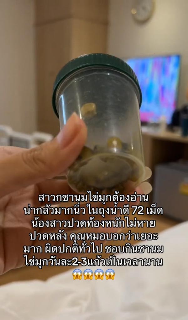 กินชานมไข่มุกเยอะจนเป็นนิ่ว