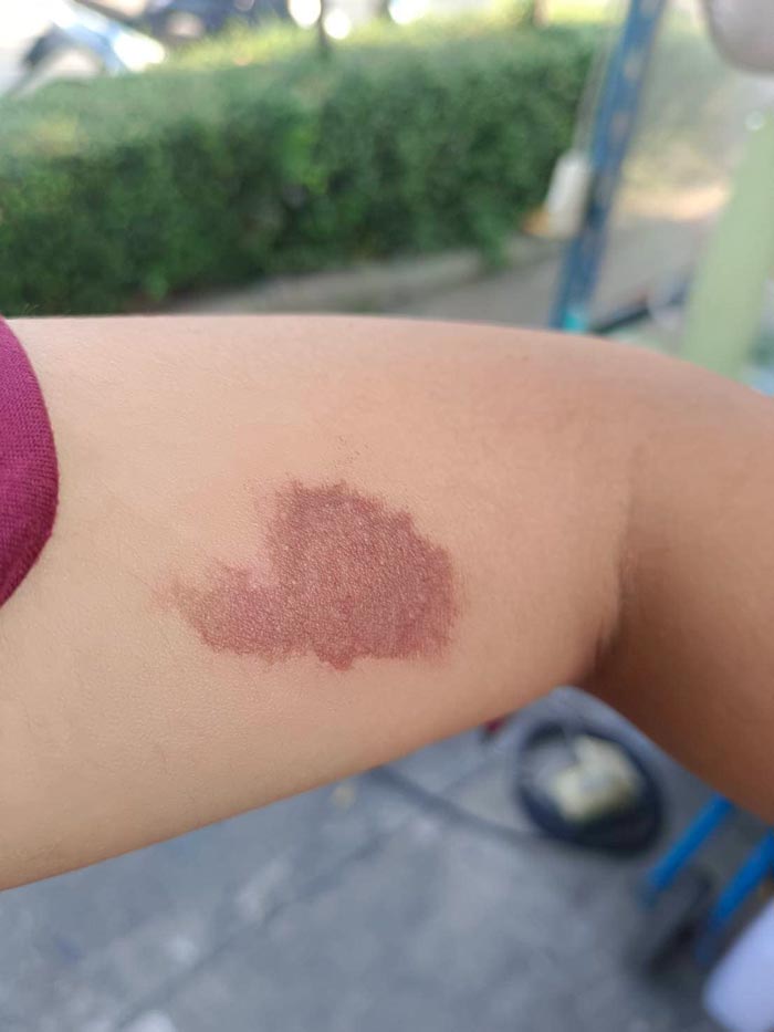 จ่ายยาให้เด็กผิด