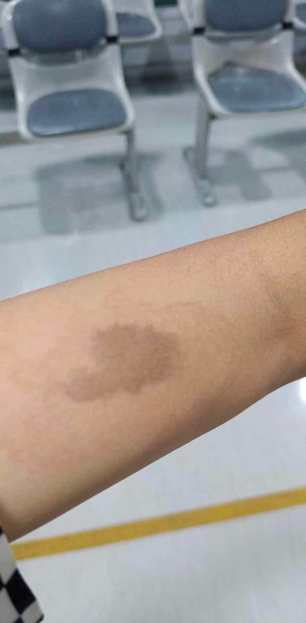 จ่ายยาให้เด็กผิด