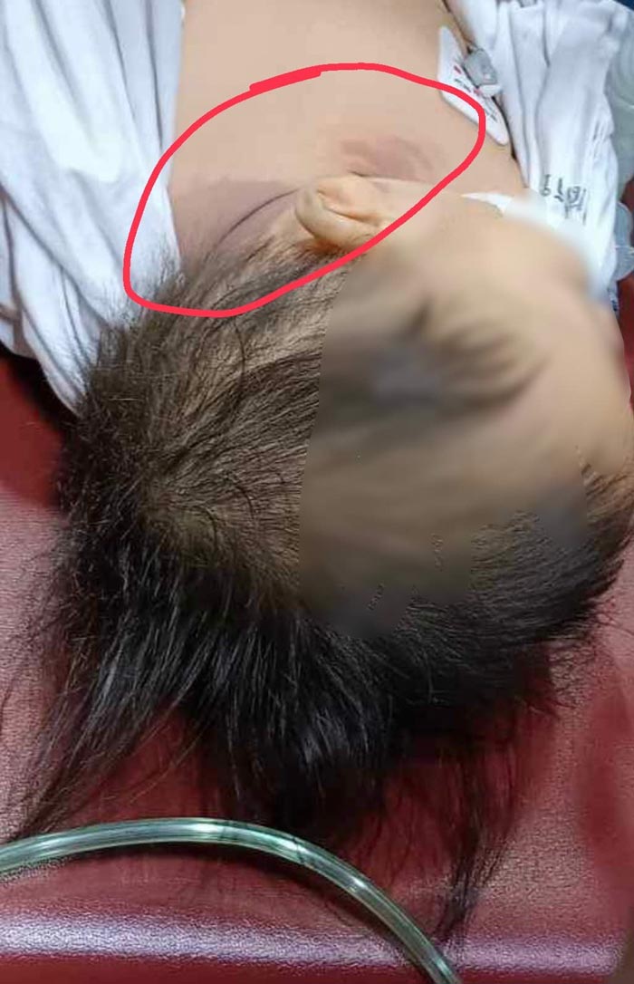 จ่ายยาให้เด็กผิด